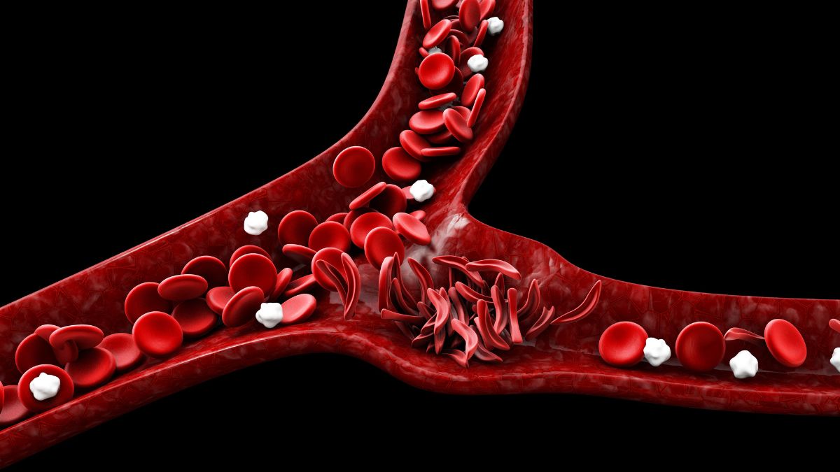 Dlaczego immunoterapia przestaje działać? Odpowiedź może kryć się w metabolizmie...