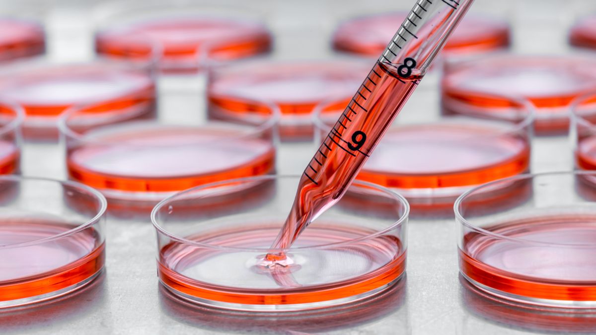 EGFR i immunoterapia w raku płuca płaskonabłonkowym: nowe podejście skojarzone z...