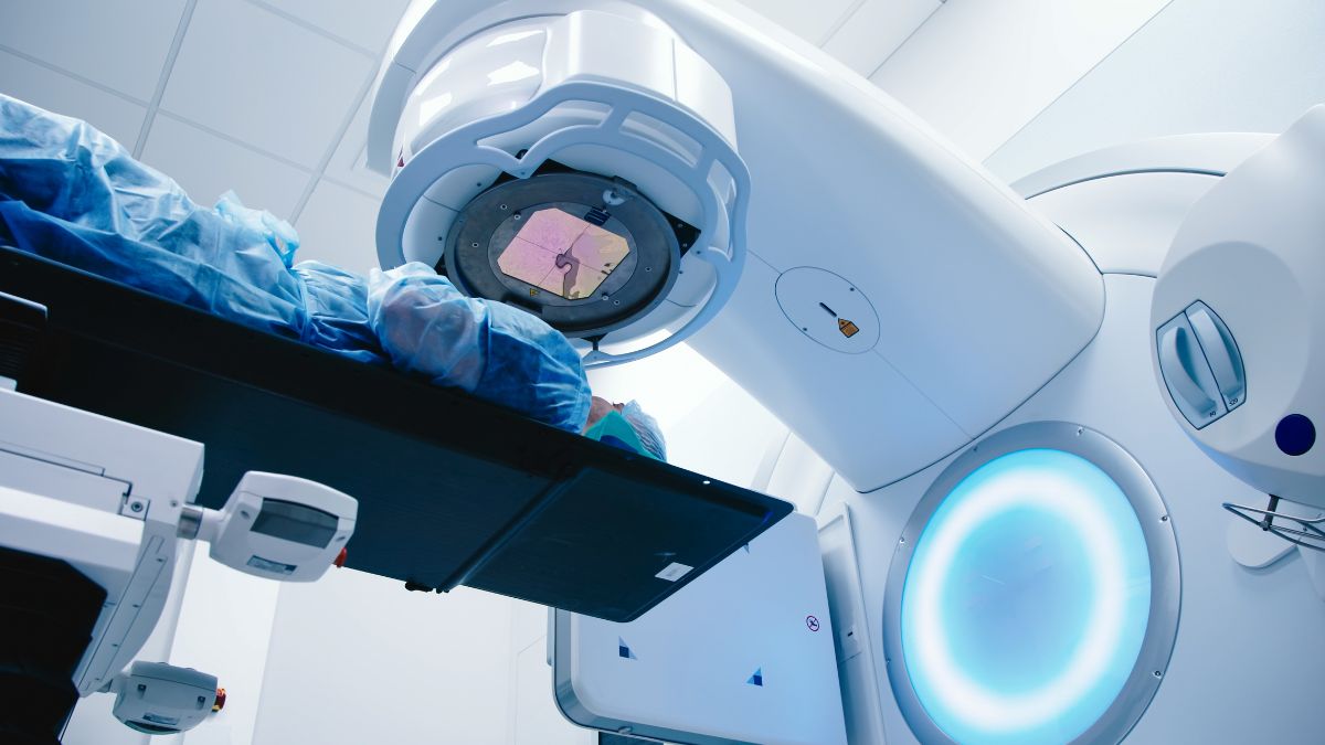 Hipofrakcjonowana radioterapia ratująca po prostatektomii nie poprawia kontroli...