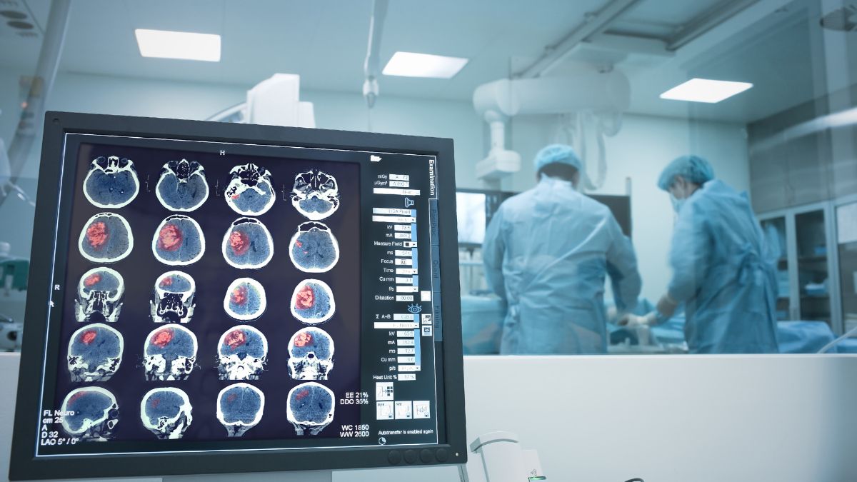 Praca nt. przełomowej terapii komórkowej glejaka z prestiżową nagrodą