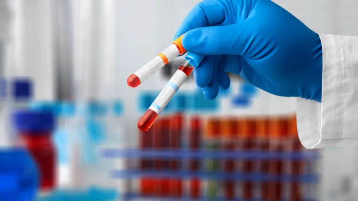 Metylacja DNA z krwi jako biomarker odpowiedzi na immunoterapię inhibitorami punktów...