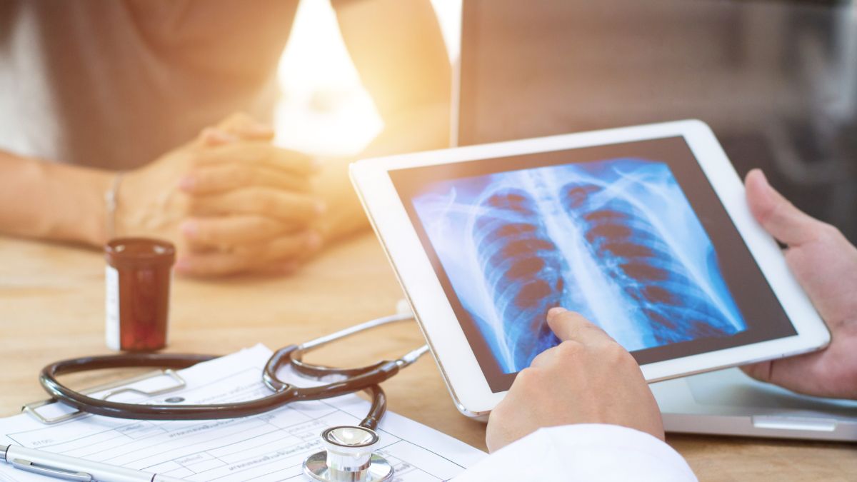 Rak płuca w stadium IV. Co oznacza diagnoza i od czego zależy leczenie?
