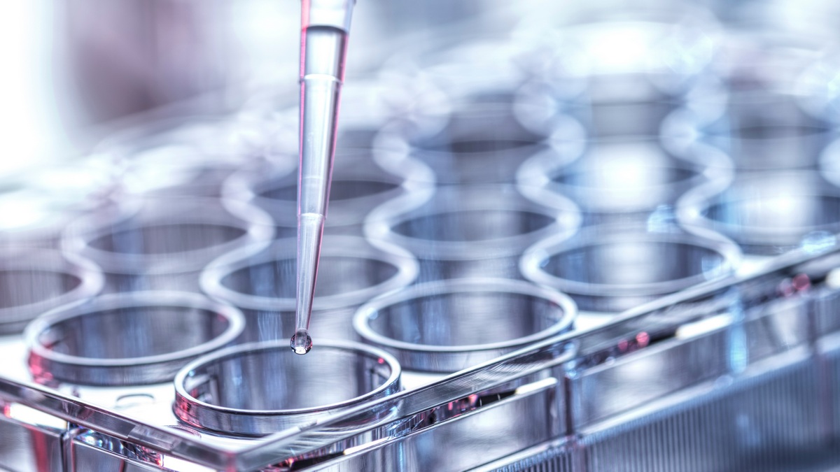 ELEVATE: czy elacestrant może stać się nową podstawą terapii hormonalnej po inhibitorach...
