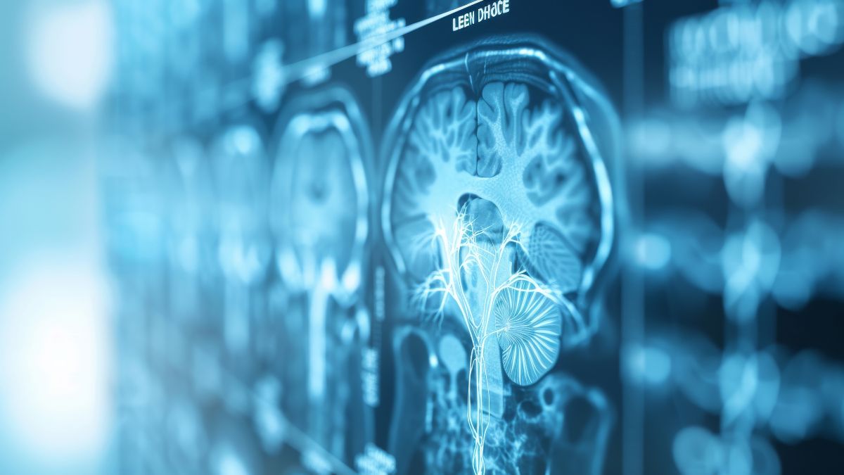 Łódź/ Pierwsza w kraju operacja usunięcia glejaka z wykorzystaniem badania PET z 18-fluorotyrozyną