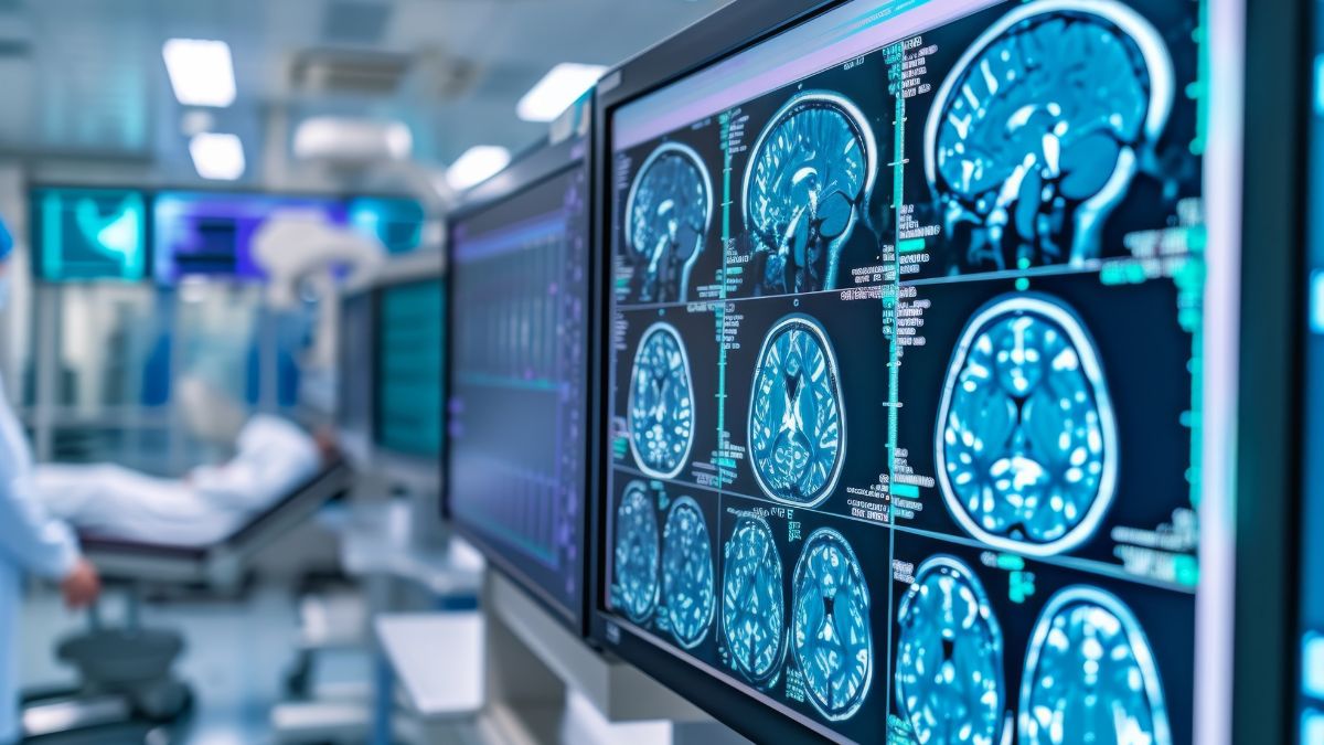 Worasidenib w leczeniu glejaków niskiego stopnia złośliwości z mutacją IDH1/2 w badaniu...