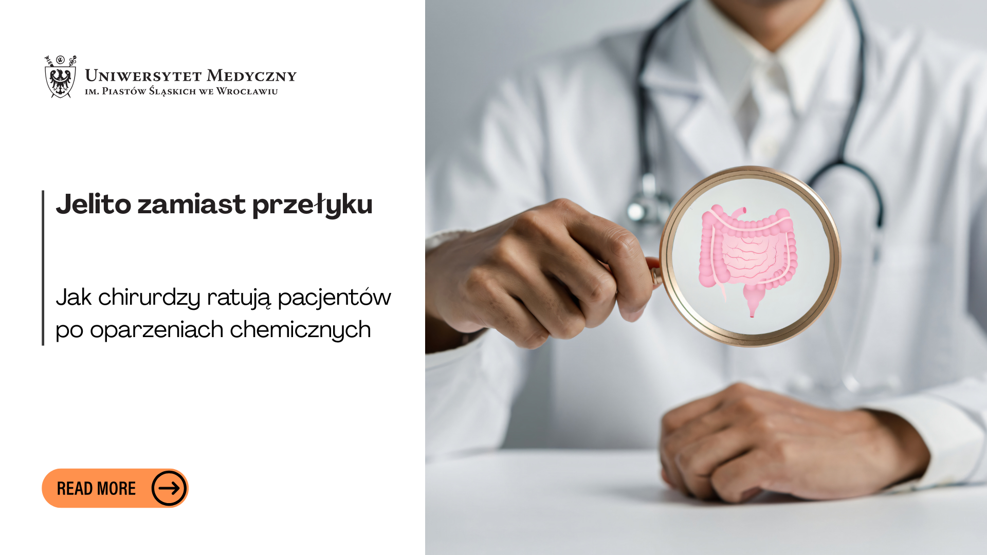 Nowy przełyk, nowe życie. Rekonstrukcja przełyku z fragmentu jelita