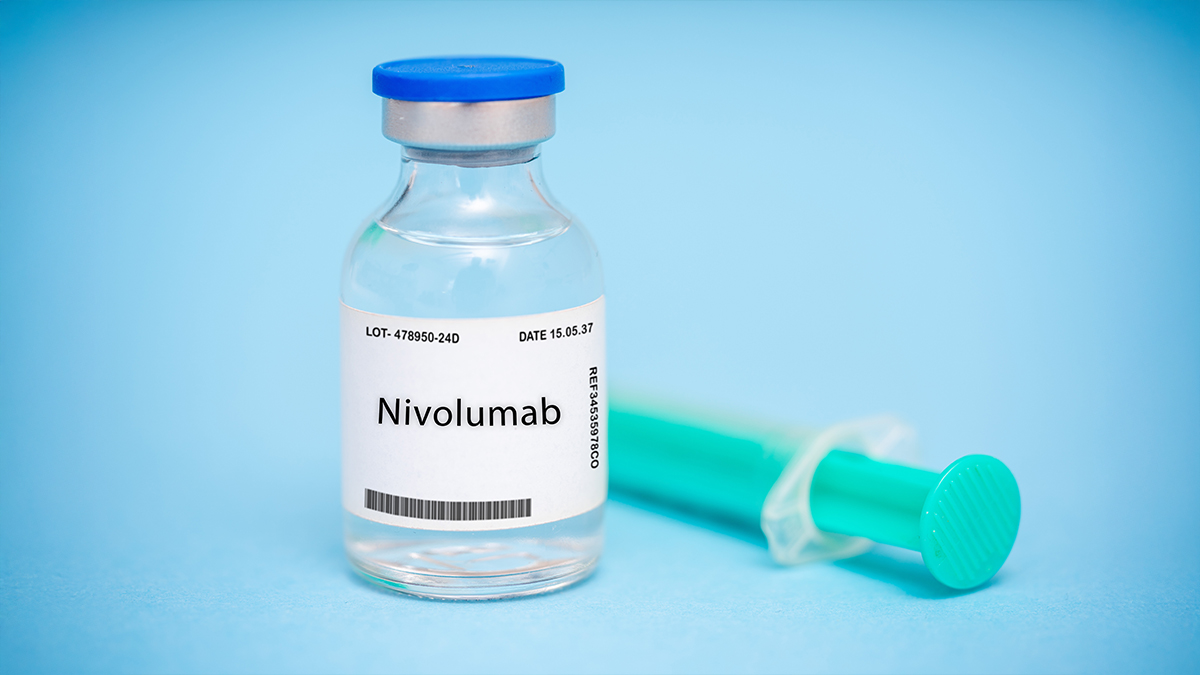 Korzyść z dodania niwolumabu do cisplatyny i radioterapii po leczeniu chirurgicznym...