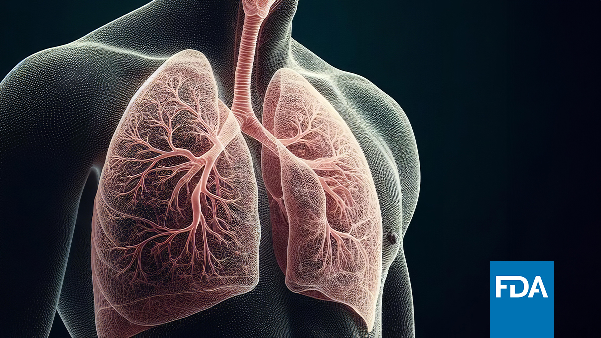 FDA zatwierdza sunwozertynib w zaawansowanym lub przerzutowym NSCLC z potwierdzoną...