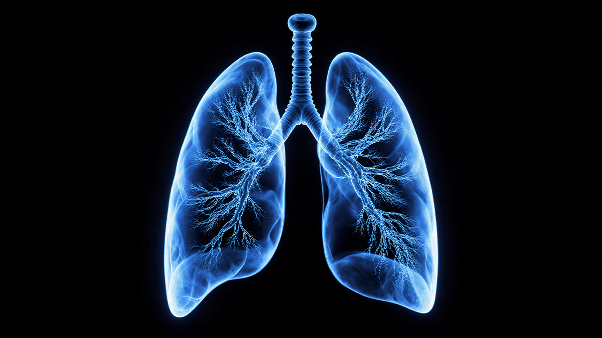 Nowa generacja leczenia okołooperacyjnego w raku płuca: wyniki badania NeoCOAST-2