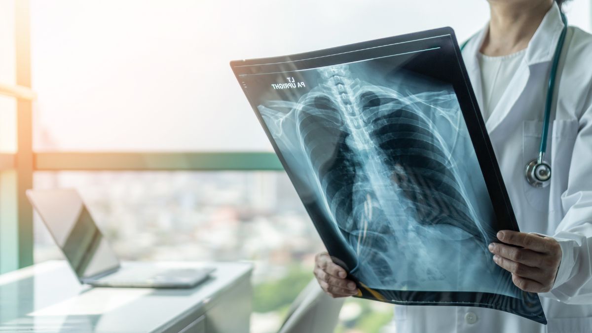 Połączenie podwójnej immunoterapii z ograniczoną chemioterapią wydłuża przeżycie...