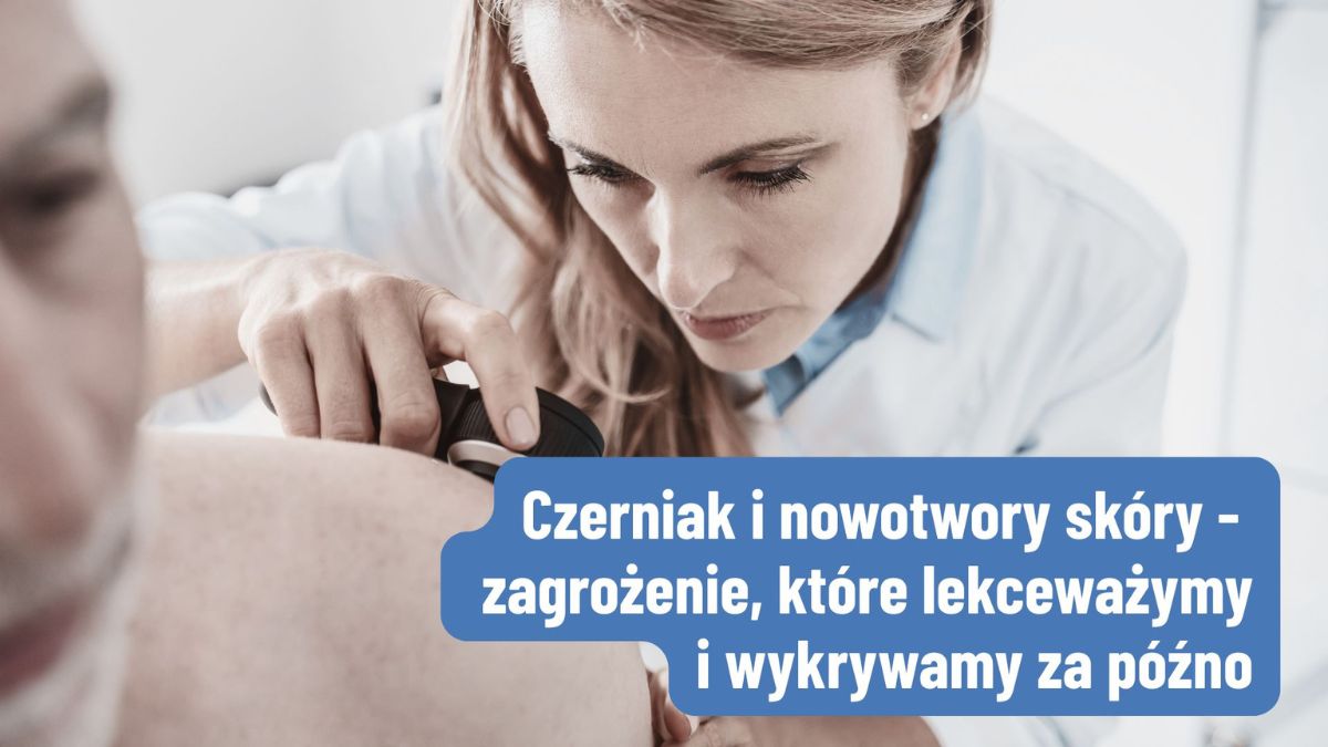Czerniak i nowotwory skóry: zagrożenie, które lekceważymy – i wykrywamy za późno