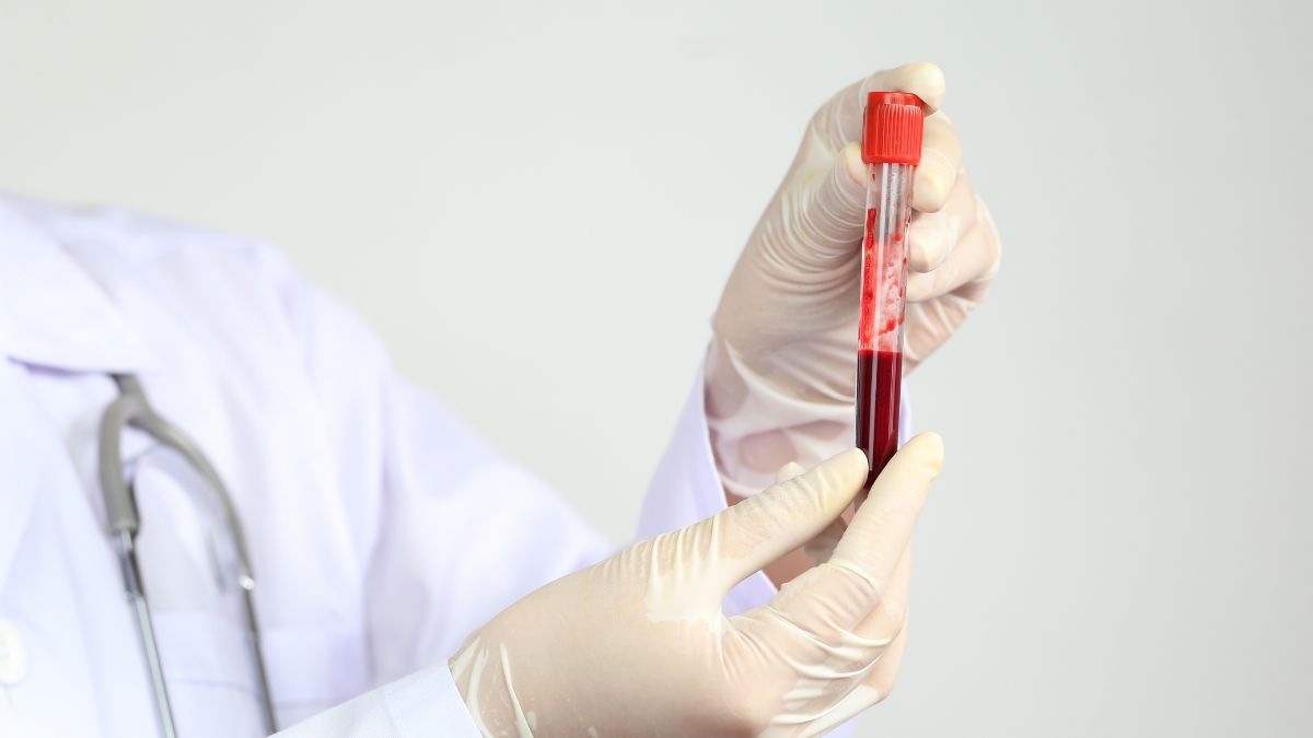 Test krwi przewidzi marskość i raka wątroby 10 lat przed objawami