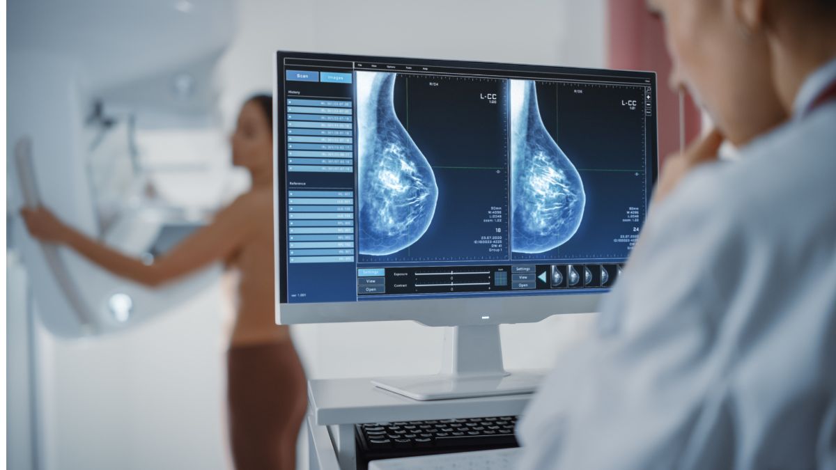 Otyłość i choroby serca a ryzyko raka piersi po menopauzie – nowe dane z badań europejskich