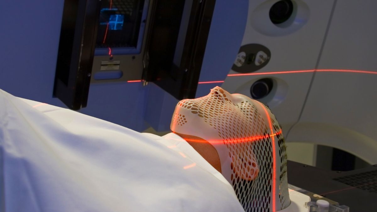 Czy protonoterapia jest lepsza niż fotonoterapia w leczeniu raka części ustnej gardła?...