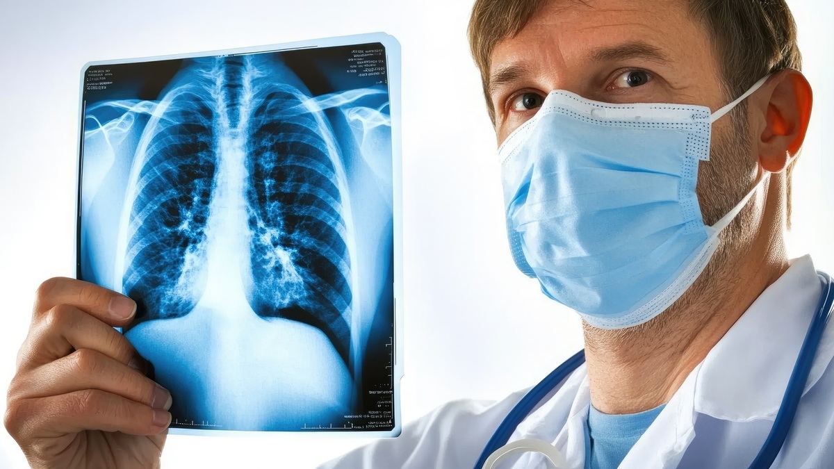 Immunoterapia okołooperacyjna w międzybłoniaku opłucnej